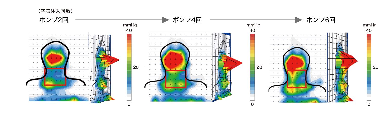 体圧分布の測定結果
